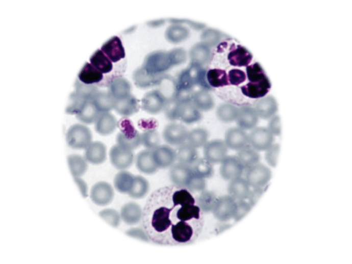 Anaplasma phagocytophilum, qPCR - Equigerminal