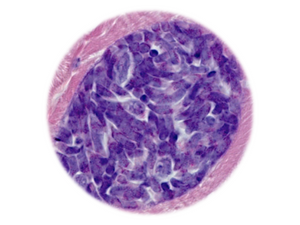 Equine Protozoa Myeloencephalitis, qPCR - Equigerminal