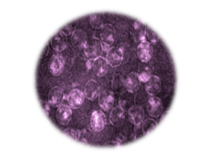 Equine Encephalosis Virus, RT-qPCR - Equigerminal