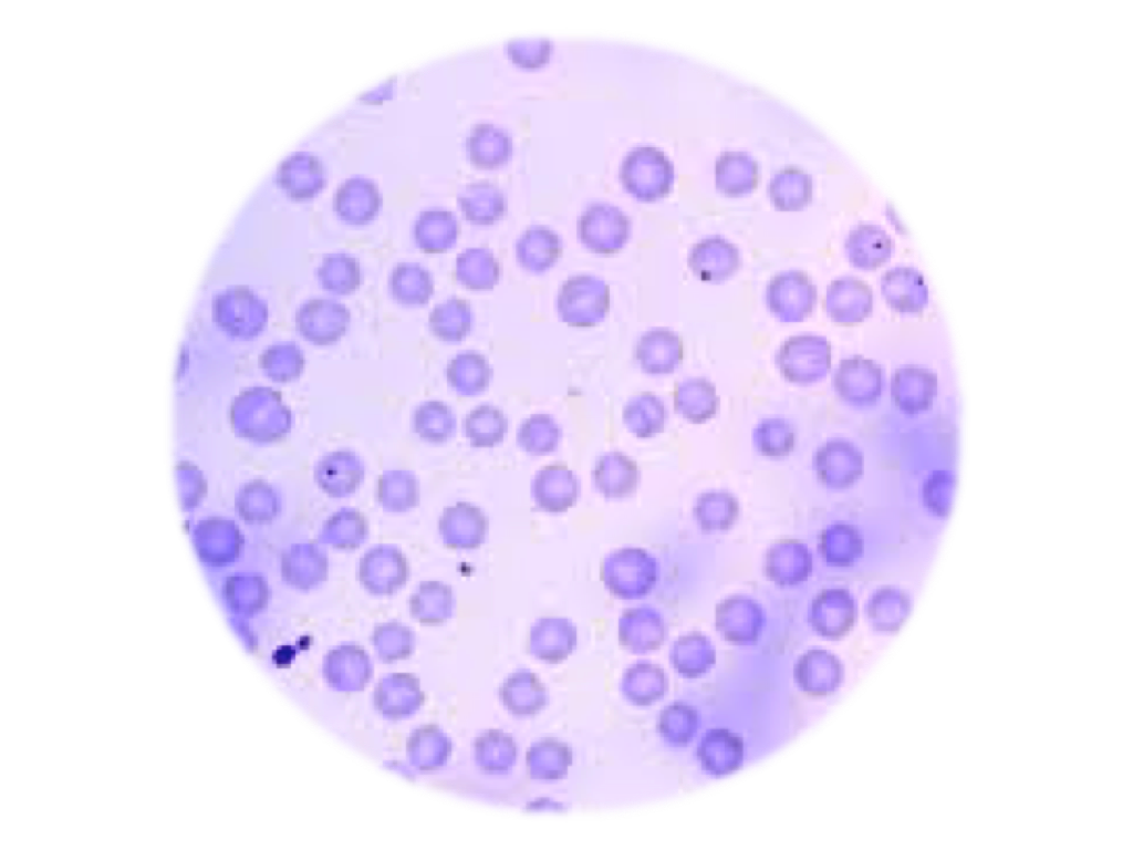 Hemoparasites, blood smear - Equigerminal