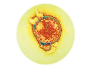 Hendra virus, RT-qPCR - Equigerminal
