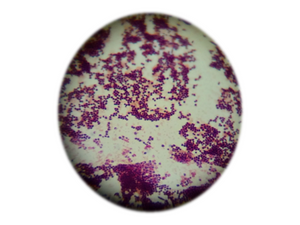Rhodococcus equi, qPCR - Equigerminal